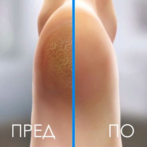 Апаратче за Педикир - Image 2